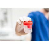 clínica de exame admissional toxicológico Portal D'Oeste clínica de exame admissional toxicológico Portal D'Oeste