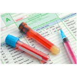 clínica de exame de sangue toxicológico contato Cidade Intercap clínica de exame de sangue toxicológico contato Cidade Intercap