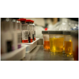 clínica de exame toxicológico para cnh Monte Serrat clínica de exame toxicológico para cnh Monte Serrat