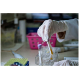 clínica de exame toxicológico para empresas contato Nova Aldeinha clínica de exame toxicológico para empresas contato Nova Aldeinha