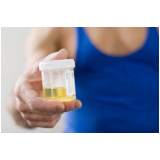 clínica de exame toxicológico para motorista Jardim Mituzi clínica de exame toxicológico para motorista Jardim Mituzi