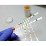 Clínica de Exame Toxicológico Particular Taboão da Serra Clínica de Exame Toxicológico Particular Taboão da Serra