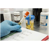 Clínica de Exame Toxicológico pelo Sangue Vila Sônia Clínica de Exame Toxicológico pelo Sangue Vila Sônia