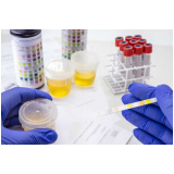 endereço de clínica de exame toxicológico particular Aldeia Serra endereço de clínica de exame toxicológico particular Aldeia Serra