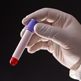 Exame de Toxicológico