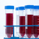onde fazer exame admissional de sangue Pestana onde fazer exame admissional de sangue Pestana
