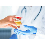 telefone de clínica de exame toxicológico cnh Ponta Porã telefone de clínica de exame toxicológico cnh Ponta Porã