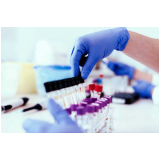 telefone de clínica de exame toxicológico periódico Biritiba Mirim telefone de clínica de exame toxicológico periódico Biritiba Mirim